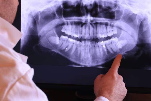 Best Emergency Root Canal Treatment in Dollar Bay, MI